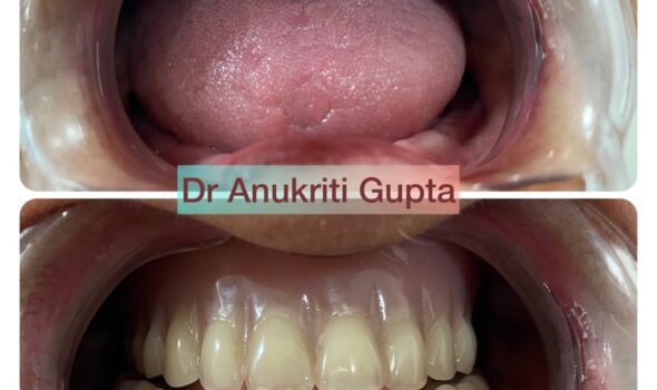 Dental Treatment Before and After