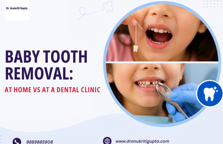 Removing a baby tooth at home vs dental clinic blog by Dr. Anukriti Gupta, Pediatric Dentist in Gurgaon.